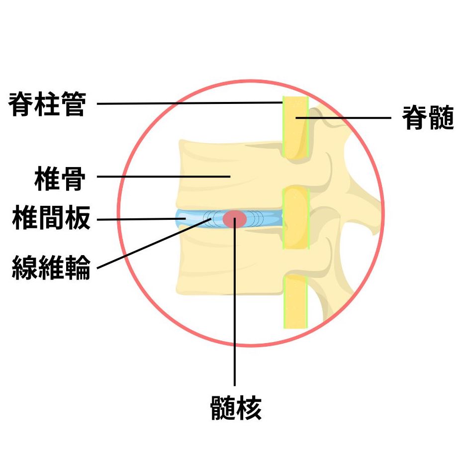 頚椎椎間板