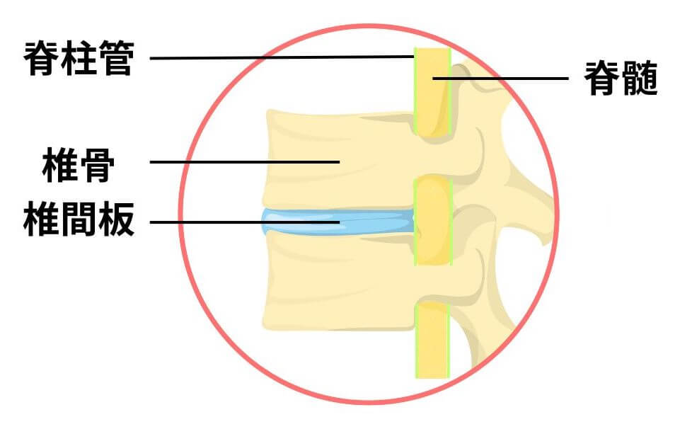 頚椎椎間板
