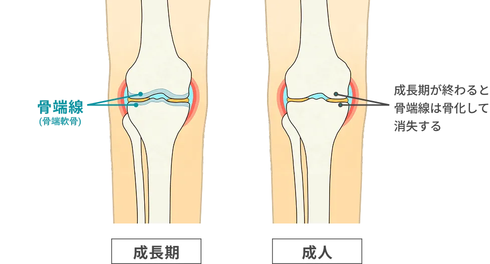 成長期と成人の骨の図